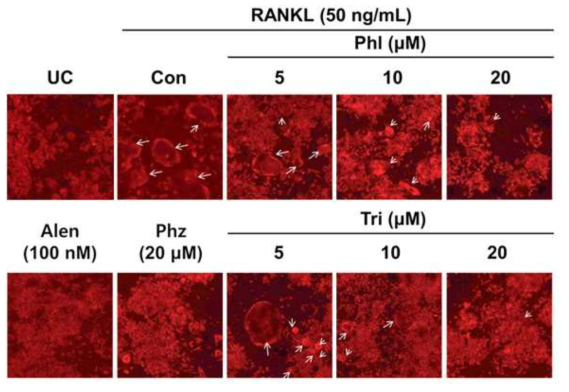Tri and Phl suppress osteoclast actin ring formation. RAW264.7 cells were cultured with and without 50 ng/ml RANKL and Tri or Phl for 5 days and stained using a rhodamine/phalloidin, and fluorescent images were taken with a confocal microscope. Arrows indicate the stained actin ring of osteoclasts. UC, undifferentiated macrophage cells; Con, differentiated osteoclast cells (treated with RANKL only); Phl, phloretin; Alen, alendronate (bisphosphonate); Phz, phlorizin; Tri, trilobatin