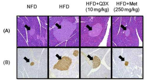 Effects of Q3X and metformin on pancreatic langerhans islet and β-cell hyperplasia in HFD-induced insulin resistance mice. Pancreatic tissue sections from each mouse of all sample treated mice group (NFD, HFD, HFD+Q3X, and HFD+Met) were analyzed. (A) The sections were stained with H HFD, high-fat diet group; HFD+Q3X, HFD with Q3X (10 mg/kg); HFD+Met, HFD with metformin (250 mg/kg); H IHC, immunohistochemistry