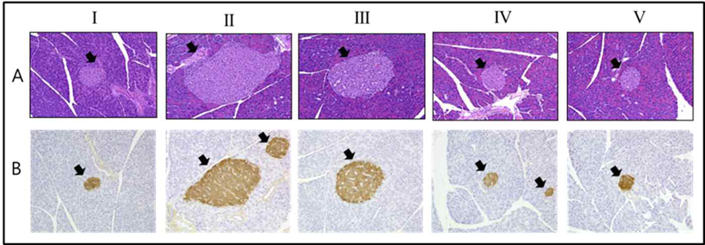 Effects of Q3X and metformin on pancreatic langerhans islet and β-cell hyperplasia in HFD-induced insulin resistance mice. H&E stained and Insulin immunostained microscopic photomicrographs of the different groups of mice, Magnification: (I-V) ×200. Mice fed with normal diet (I), HFD (II) and HFD supplemented with Q3R 10 (III), Q3R 15 (IV) and Metformin 250 mg/kg (V) were sacrificed after four weeks and the pathophysiology of pancreas was evaluated by H & E staining (A) and immunohistochemical staining (B). H & E staining revealed the structure of islets while immunohistochemical staining indicated the production of insulin in the β cells. Q3R (III and IV) and metformin (V) improved the islet size and normal cellular arrangement and reduced the positive insulin immunoreactivity compared to HFD group