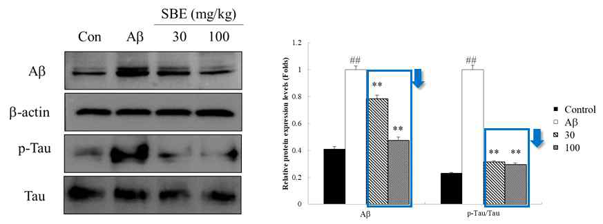 b-amyloid, tau 과인산화 단백질 변화 측정