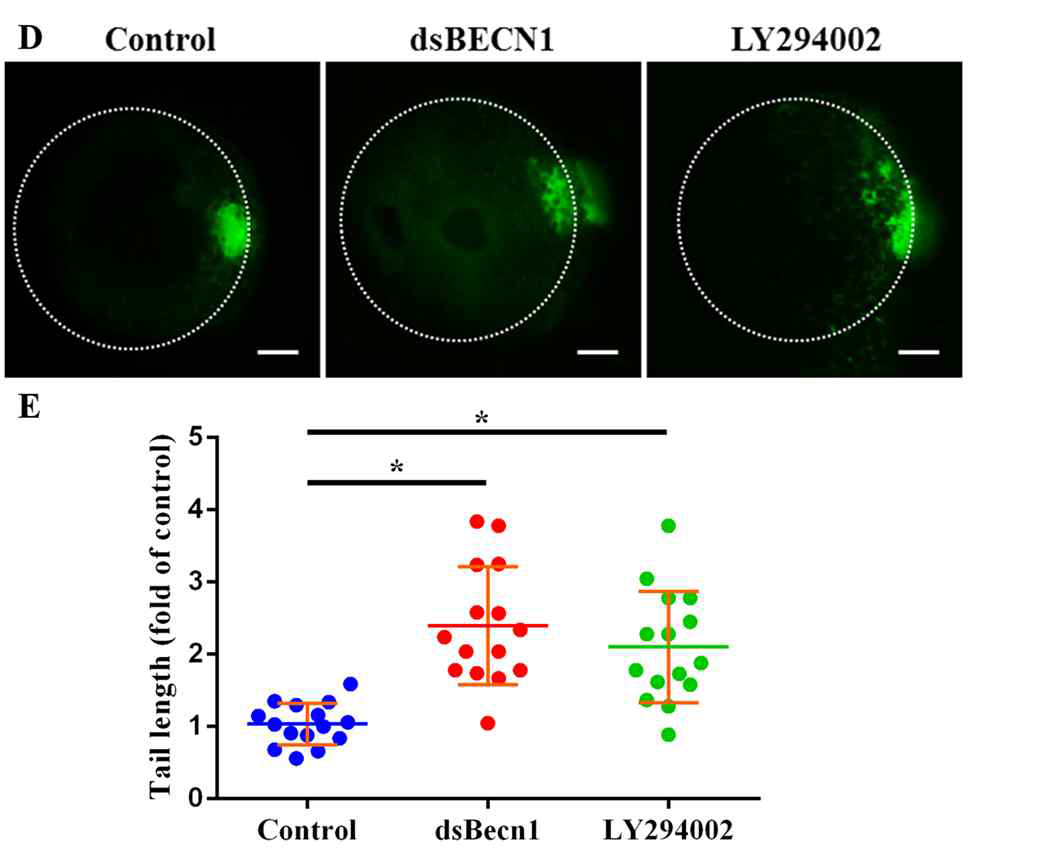 Beclin 억제에 따른 Comet assay 분석