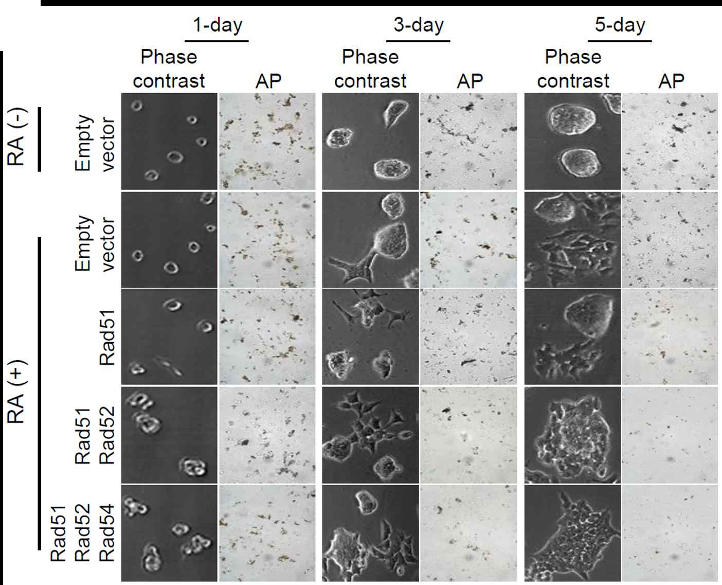 Alkaline phosphatase (AP) 세포염색