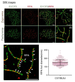 초고해상도 현미경을 통해 확인한 RPA 단백질