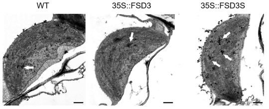 FSD3, FSD3S 과발현 형질전환 식물에서의 엽록체 발달. 야생형, 35S::FSD3, 35S::FSD3S 과발현 식물에서 엽록체 구조를 보여주는 전자현미경 이미지. 흰색 화살표는 plastoglobuli를 표시하고 있음