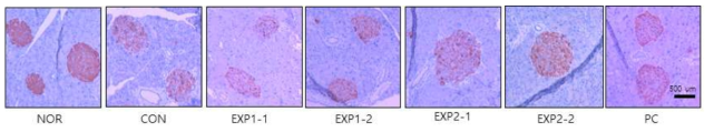 Comparison of immunoreactive cells in pancreatic islets in diabetic mice stained by insulin immunohistochemistry