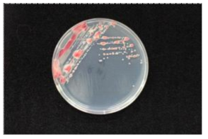 TTC 배지에서 배양한 R. solanacearum colony