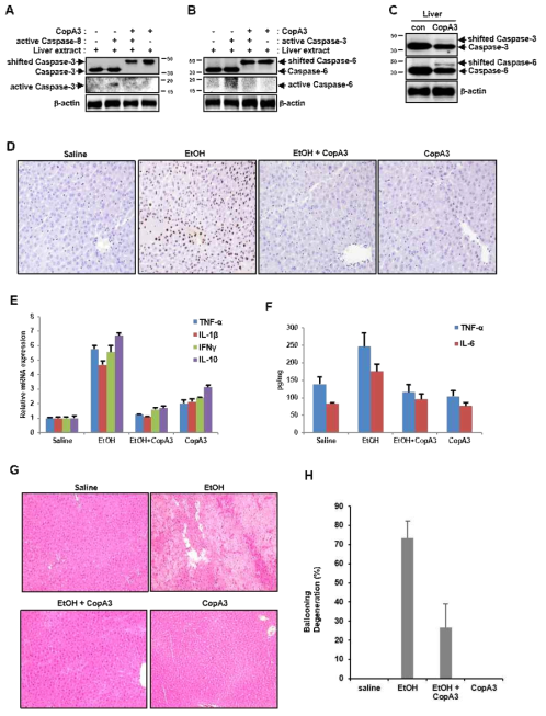 세포자살을 억제하는 CopA3가 알코올성 간질환에 높은 치료적 효과를 보임