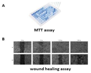 암세포 사멸 및 이동 조절 활성 실험 system (MTT assay, wound healing assay) 구축