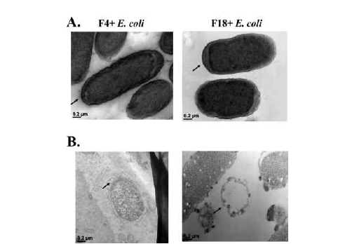 Transmission electron microscopy (TEM), (A) 누에 추출물 미처리 군 (B) 누에 추출물 처리 군