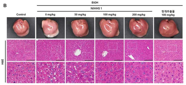 도라지 처리(NIHHS1)군 실험쥐의 간조직학적 변화 분석