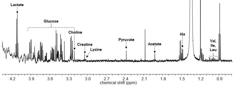 마우스 혈청의 600 MHz NMR 스펙트럼