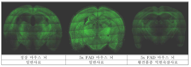 황견품종 익힌숙잠 섭취 5x FAD 치매 마우스의 독성 b-amyloid 발생결과