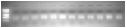 무작위로 선발한 샘플의 PCR 증폭(amplification) 산물이 100-600 bp 사이에 퍼져서 밴드를 형성하므로 염기서열 분석에 적합하게 library가 작성되었음을 확인함