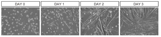 마우스의 근아세포 (myoblast)에서 근관세포 (myotube)로의 분화 과정 현미경 사진