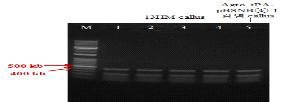13HM 캘러스 bar 유전자 (412 bp) 확인 결과(bar_2019 primer 이용) (M: 1kb+ DNA Ladder, 1, 2: 13HM 3-1 캘러스, 3, 4: 13HM 6-4 캘러스, 5: Agro. tPA-pBSNB④-1 감염 2-4 (DJ))