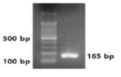 강낭콩 잎의 gDNA로부터 증폭한 165 bp의 phytoene desaturase DNA 단편 조각