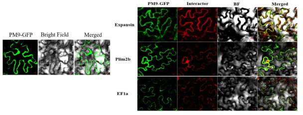 PM9와 단백질 상호작용 유전자의 세포 내 위치확인