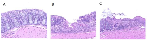 장염이 유발된 동물 모델의 장내 병리 조직학적 관찰 (A) Normal; (B) DSS 처리군; (C) DSS + 시료 D