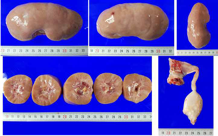 이식편(돼지) 신장 및 요관, 방광 이식편 신장 27.9g → 170.18g 무게 증가, 부검시 장축 약 11.5cm, 단축 약 5cm