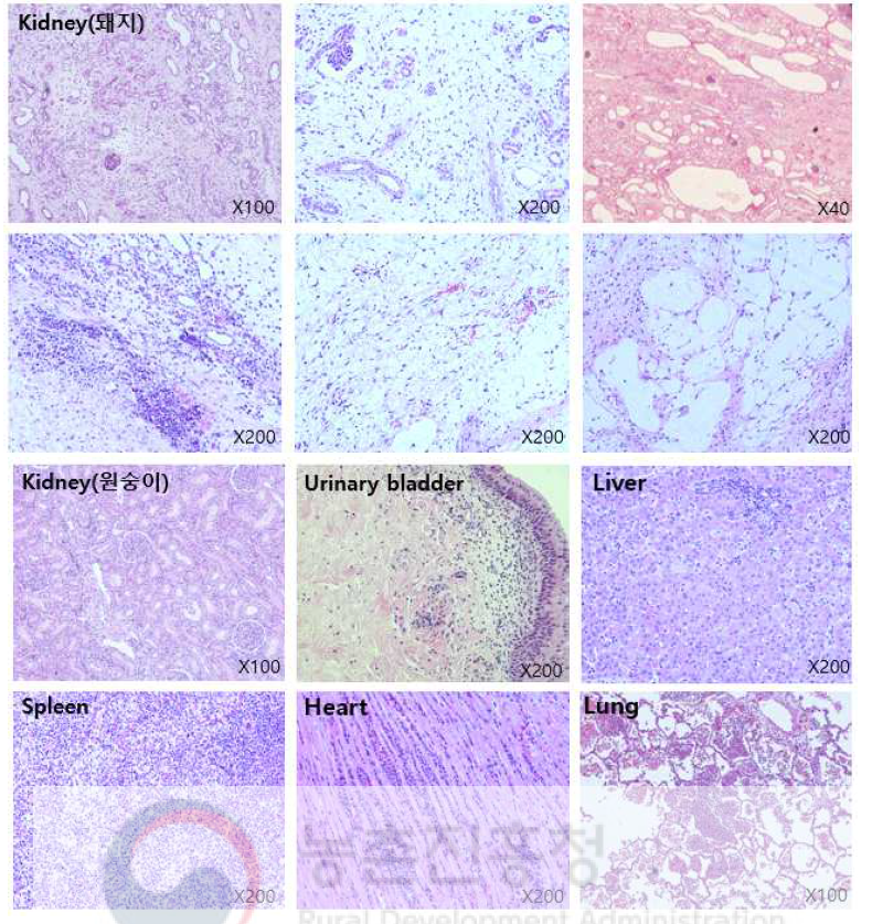 28-03 개체 POD84 종료 ○ Kidney(돼지): - Patchy tubulointerstitial tissue loss, suspicious of reflux nephropathy - Interstitial fibrosis with mononuclear cell infiltration, diffuse - Tubular dilatation, atrophy, casts with Tamm-Horsfall protein and fraying of tubular epithelial cells - No tubulitis -“obstructive” glomerular changes (crowded appearance, small size, mild collapse, wrinkling of glomerular capillaries, enlarged urinary spaces) - Renal pelvis: fatty change, acute inflammation, foamy histiocytes - Blood vessel: fibrointimal thickening, organizing thrombus ○ Kidney(원숭이): Acute and chronic pyelonephritis ○ Urinary bladder: Acute cystitis ○ Liver: Acute hepatitis with liver cell necrosis ○ Spleen: Acute splenitis with microabscess ○ Heart: Acute myocarditis ○ Lung: Pneumonia with bacterial colonies