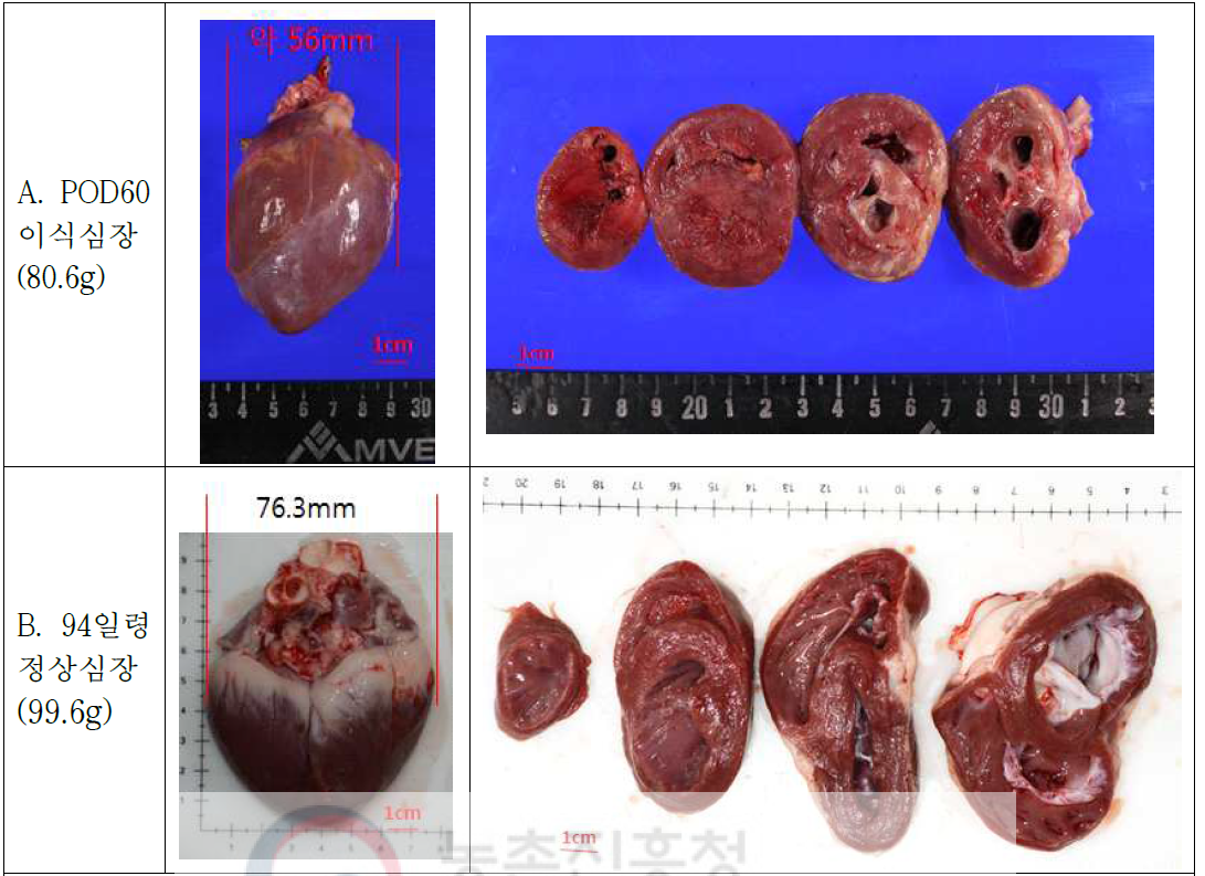 이종이식 돼지 심장의 형태학적 분석. 원숭이에 이식된 돼지의 심장(A)은 정상 심장(B)에 비해 성장하는 것이 아니라 비정상적으로 비대해지는 것을 확인