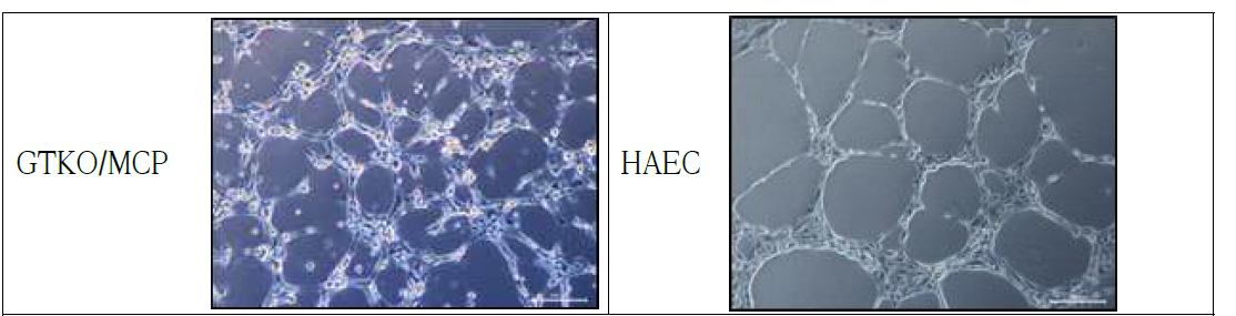 GTKO/MCP 돼지의 대동맥에서 분리 배양한 혈관내피세포. HAEC. 대조군으로 사람 대동맥 혈관내포