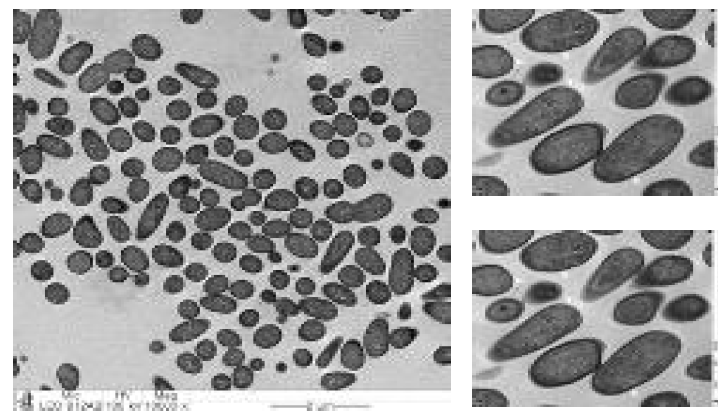 투과전자현미경(TEM)을 이용한 처리 전 L. monocytogenes의 내부 촬영