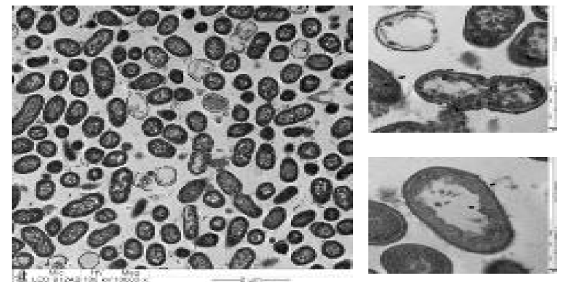TEM을 이용한 3% lactic acid 처리 후 L. monocytogenes의 내부 촬영