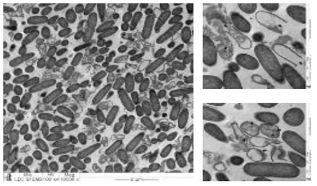 TEM을 이용한 3% lactic acid와 405 nm LED의 병용 처리후 L. monocytogenes의 내부 촬영