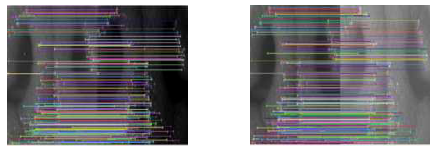 The matching of varying intensity image(Left: comparison with –50 intensity; Right: comparison with +50 intensity)