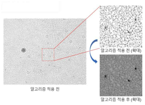 혈구도말 슬라이드를 촬영한 이미지. (좌) 원본 저해상도 이미지. (우상단) 원본 저해상도 이미지 확대. (우하단) 합성한 고해상도 이미지 확대