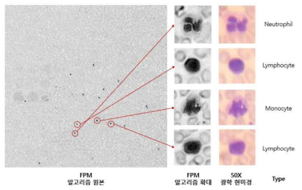 혈구도말 슬라이드를 촬영한 이미지. (좌) 합성한 고해상도 이미지. (중앙) 합성한 고해상도 이미지에서 백혈구 확대. (우) 50X 광학 현미경으로 동일 위치 촬영한 이미지