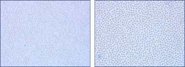 Giemsa Stain 과 Methylene Blue 배합