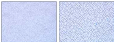 Wright Stain 과 Methylene Blue 배합