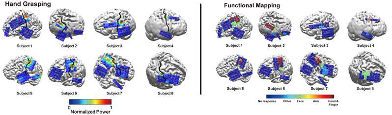 운동 중 발생한 ECoG 고주파 뇌신호의 공간적 패턴(좌). ECoG 뇌자극에 대한 감각 경험의 functional mapping 결과(우)
