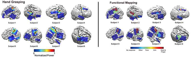 운동 중 발생한 ECoG 고주파 뇌신호의 공간적 패턴(좌). 대부분의 고주파 뇌활동이 일차 체성감각피질에서 나타남을 볼 수 있음. ECoG 뇌자극에 대한 감각 경험의 functional mapping 결과(우). 고주파 뇌반응이 강하게 나타난 영역과 뇌자극 시 감각 경험을 보고한 영역이 거의 일치함