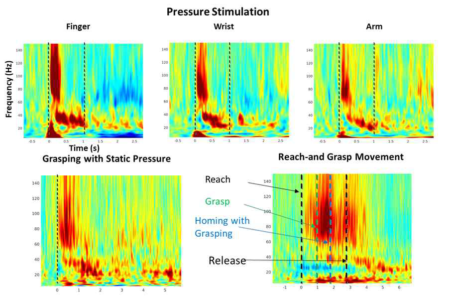 (위)손가락, 팔목, 팔에 대한 압감 자극 시 vPM 뇌반응, (왼쪽 아래) 잡기 운동 중의 vPM 뇌반응, (오른쪽 아래)뻗어서 잡기 시의 vPM 뇌반응