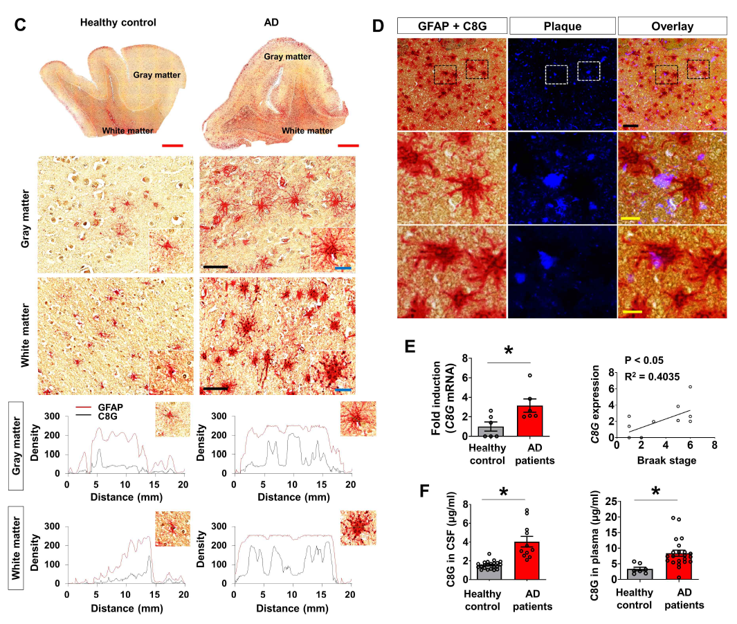 알츠하이머병 환자의 뇌조직 및 체액에서 C8G 발현 확인