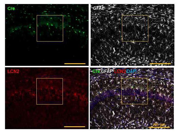 성상교세포 특이적 LCN2 발현 뇌염증 동물모델 구축. 성상교세포의 Cre 바이러스 발현 확인 및 LCN2 발현 확인
