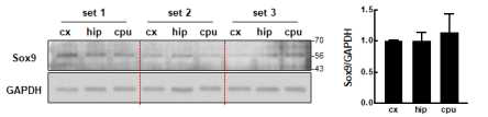 Sox9 expression in different brain regions