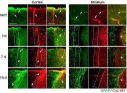 Blood vessel formation play critical roles for astroglial scar formation in the cortex and the striatum