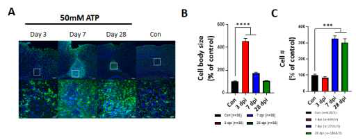 ATP 주입 후, 3일, 7일, 28일에 관찰된 CX3CR1-GFP(+) 세포체 크기와 수의 변화