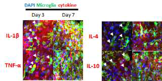 ATP 손상 후에, 발현되는 사이토카인과 CX3CR1-GFP의 면역염색실험