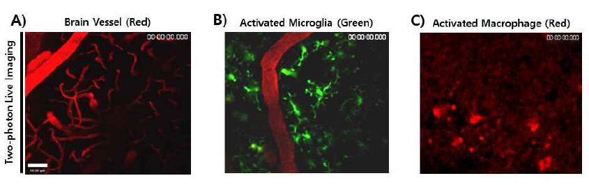 이광자현미경을 이용하여 뇌혈관 및 뇌염증 관여 세포 관찰