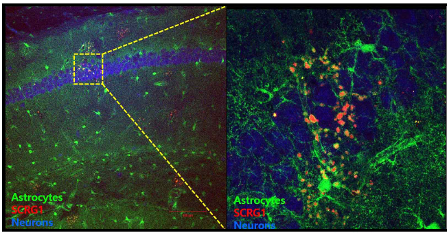 알츠하이머 병 모델 쥐 뇌에서 존재하는 별아교세포에서 선택적으로 발현 증가하는 SCRG1