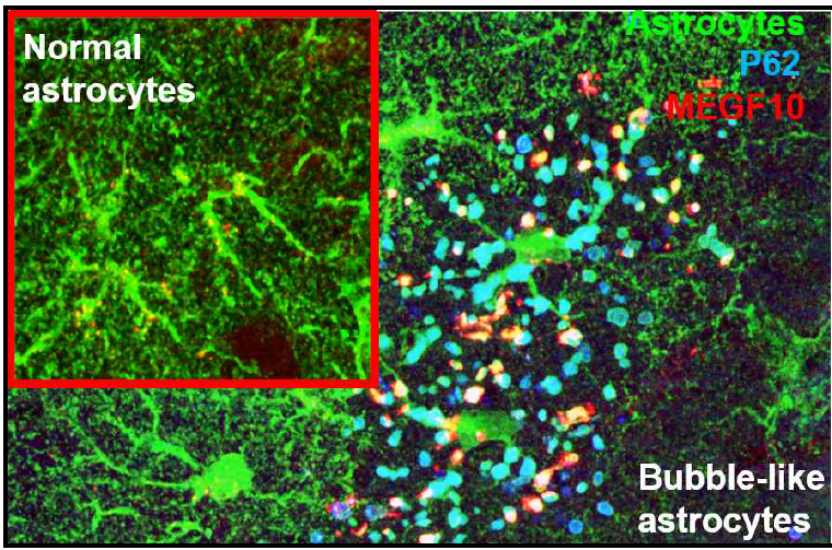 알츠하이머 별아교세포 autophagosome에 비정상적으로 축적되어 있는 MEGF10 단백질