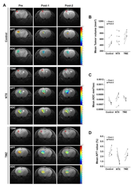 APT (Amide Proton transfer) imaging과 DWI (Diffusion weighted imaging)의 치료 효과 예측 비교