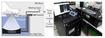 구축된 MR영상유도 집중 초음파 시스템