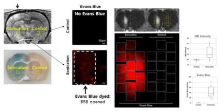 MR영상 및 형광이미징을 통하여 BBB 개통 확인 및 정량화