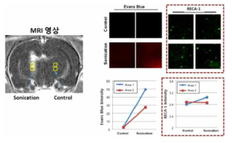 RECA-1 염색을 통한 BBB 개폐 안전성 평가